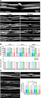 Neuroprotection and Axonal Regeneration Induced by Bone Marrow Mesenchymal Stromal Cells Depend on the Type of Transplant